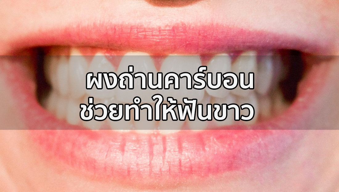 Website เปลียนรูป 1