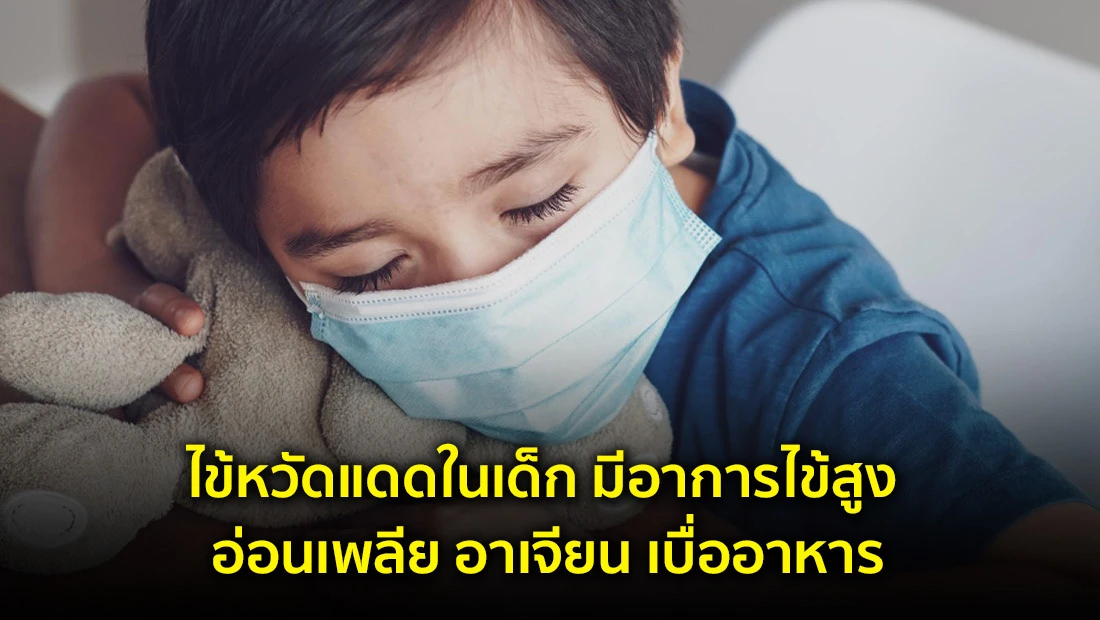 ไข้หวัดแดดในเด็ก มีอาการไข้สูง อ่อนเพลีย อาเจียน เบื่ออาหาร