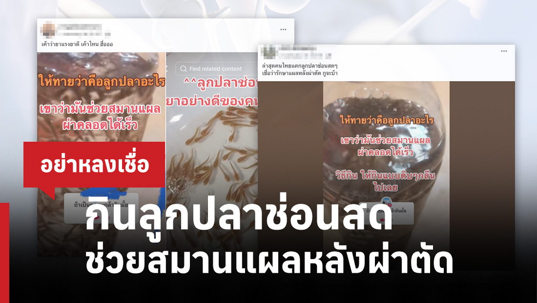กินลูกปลาช่อนสด ช่วยสมานแผลหลังผ่าตัด
